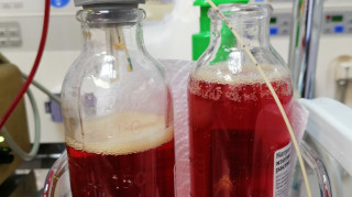 Плазмаферез при пироплазмозе у собак — удаление продуктов гемолиза, тёмно-красная плазма с гемоглобином. Ветеринарный нефролог.