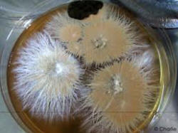 Лишайные грибы растут на питательной среде в чашке петри в лаборатории